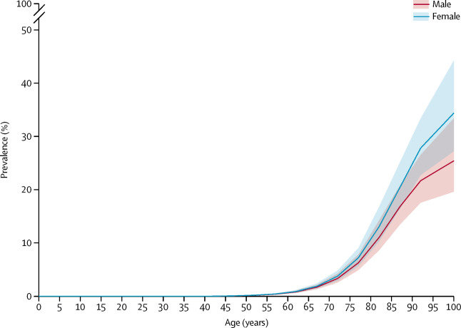 Global prevalence Alzheimer